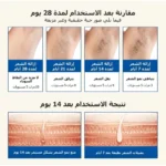 باندل الجمال جهاز ال KINSEIBEAUTY  + الهيدروفيشيال هديه - Image 3